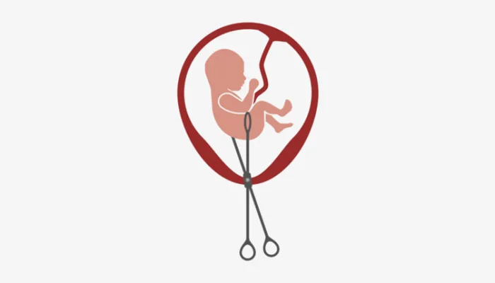 Abortus u Njemačkoj – Prava, zakonska regulativa, postupak, iskustva i podrška za žene