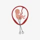 Abortus u Njemačkoj