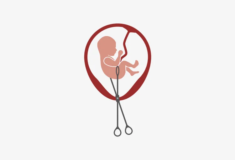 Abortus u Njemačkoj